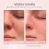 Vaporizador facial nano-iónico, vapor caliente para sauna o SPA casero - Imagen 5
