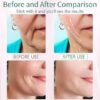 Terapia de luz roja 7 en 1 para cara y cuello - Imagen 4