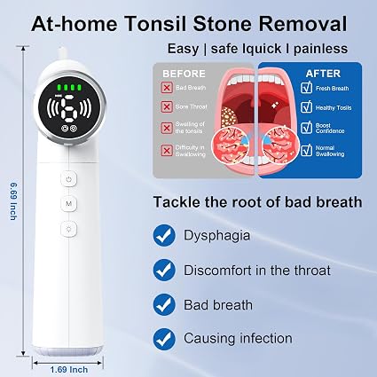 Herramienta mejorada para remover cálculos amigdalinos - Aspirador recargable. - Imagen 6